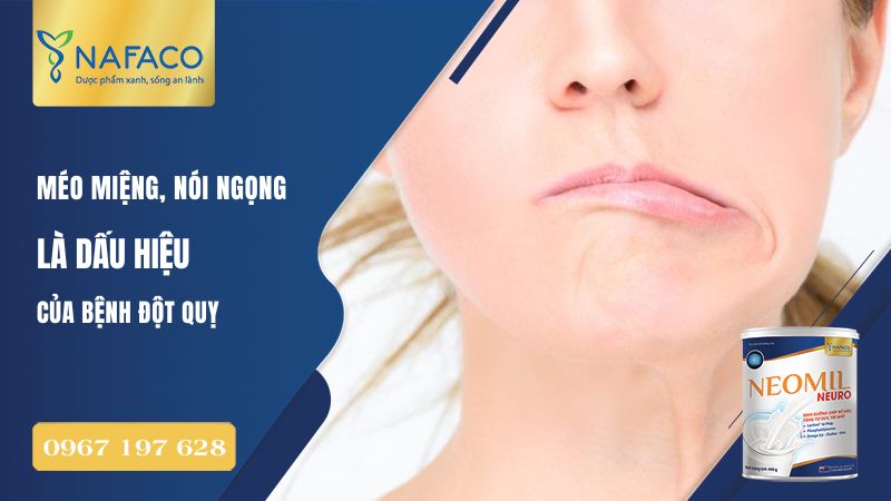 bệnh đột quỵ nguyên nhân và cách phòng tránh